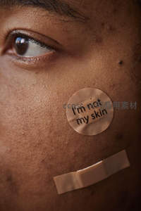 贴有标语贴纸的自信肌肤特写