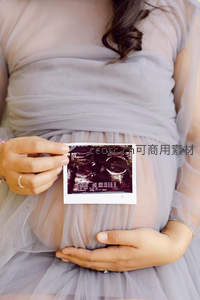轻纱孕肚捧超声影像，温柔守护